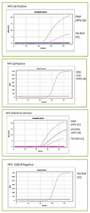 PV 16 & 18  Detection