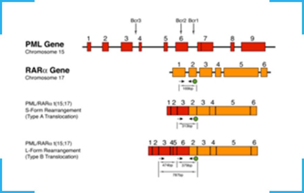 PML RARA PCR Kit | PML RARA quantitative kit | PML RARA RT PCR Kit