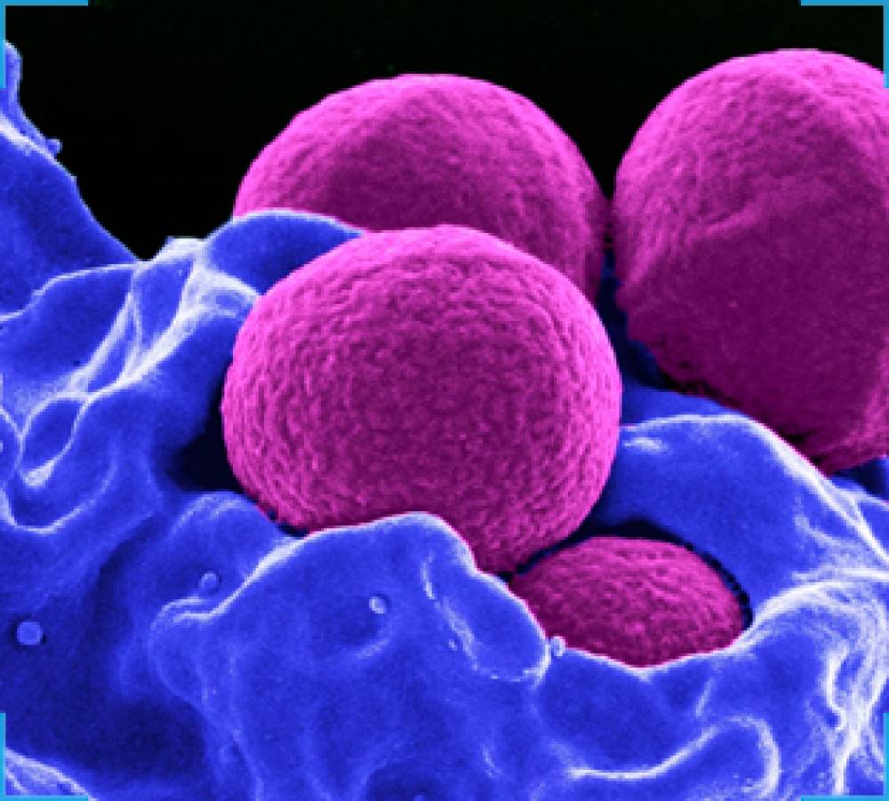 MRSA Detection