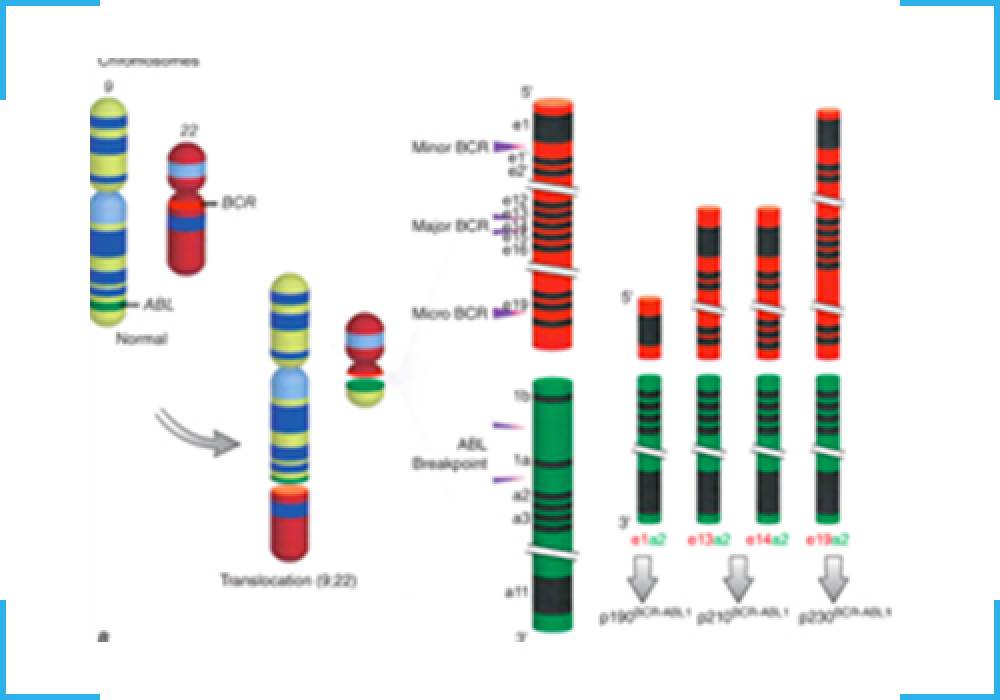 BCR-ABL1 Qualitative