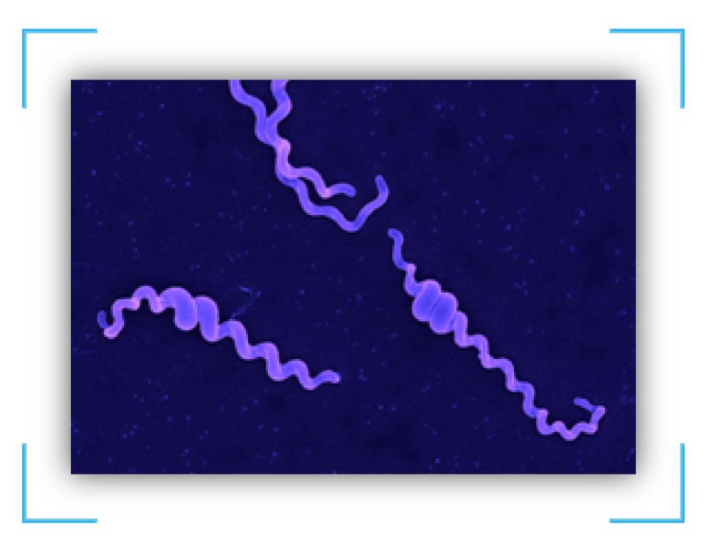 Leptospira Detection Kit