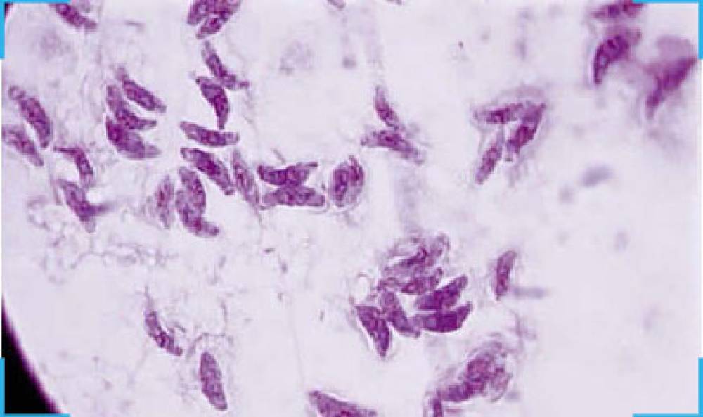 Toxoplasma Detection